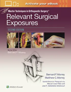 Morrey |  Master Techniques in Orthopaedic Surgery | Buch |  Sack Fachmedien