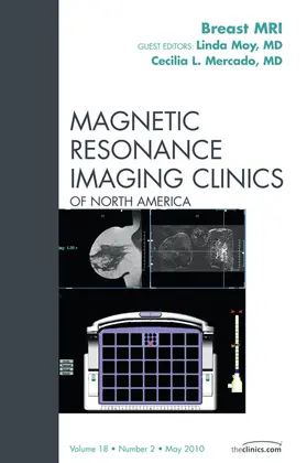 Moy / Mercado |  Breast MRI, An Issue of Magnetic Resonance Imaging Clinics | eBook | Sack Fachmedien