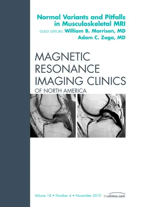 Morrison / Zoga |  Normal Variants and Pitfalls in Musculoskeletal MRI, An Issu | Buch |  Sack Fachmedien