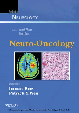 Rees / Wen |  Neuro-Oncology | eBook | Sack Fachmedien