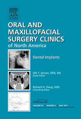 Jensen |  Dental Implants, an Issue of Oral and Maxillofacial Surgery Clinics | Buch |  Sack Fachmedien