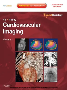 Ho MD / Reddy MD |  Cardiovascular Imaging E-Book | eBook | Sack Fachmedien