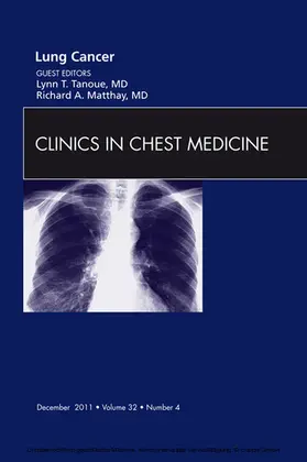 Tanoue / Matthay |  Lung Cancer, An Issue of Clinics in Chest Medicine | eBook | Sack Fachmedien