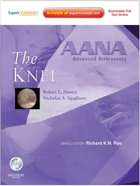 Hunter / Sgaglione |  AANA Advanced Arthroscopy: The Knee E-Book | eBook | Sack Fachmedien