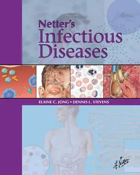 Jong MD |  Netter's Infectious Diseases E-Book | eBook | Sack Fachmedien