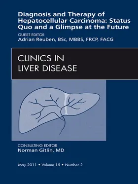 Reuben BSc / Reuben |  Hepatocellular Carcinoma, An Issue of Clinics in Liver Disease | eBook | Sack Fachmedien
