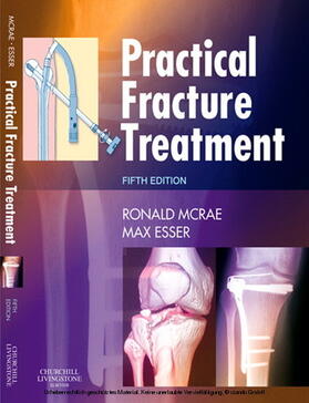 McRae / Esser | Practical Fracture Treatment E-Book | E-Book | sack.de