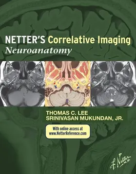 Lee MD / Mukundan |  Netter's Correlative Imaging: Neuroanatomy | eBook | Sack Fachmedien
