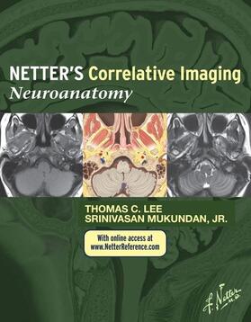 Mukundan | Netter's Correlative Imaging: Neuroanatomy | E-Book | sack.de