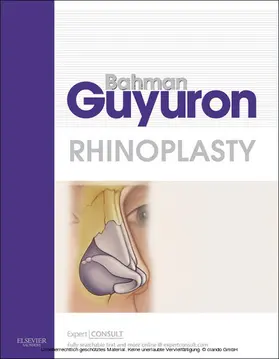 Guyuron MD / Guyuron |  Rhinoplasty E-Book | eBook | Sack Fachmedien