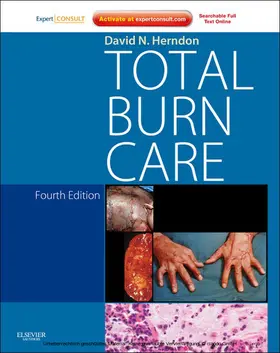 Herndon |  Total Burn Care | eBook | Sack Fachmedien