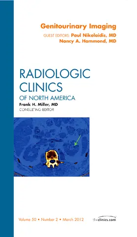 Nikolaidis / Hammond | Genitourinary Imaging, an Issue of Radiologic Clinics of North America | Buch | 978-1-4557-4464-0 | sack.de