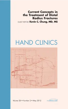 Chung | Current Concepts in the Treatment of Distal Radius Fractures, an Issue of Hand Clinics | Buch | 978-1-4557-4562-3 | sack.de