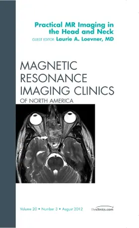Loevner | Practical MR Imaging in the Head and Neck, an Issue of Magnetic Resonance Imaging Clinics | Buch | 978-1-4557-4699-6 | www.sack.de