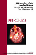 Yao |  PET Imaging of the Head and Neck,  An Issue of PET Clinics | eBook | Sack Fachmedien
