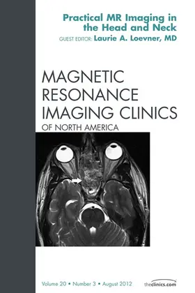Loevner |  Head and Neck MRI, An Issue of Magnetic Resonance Imaging Clinics | eBook | Sack Fachmedien