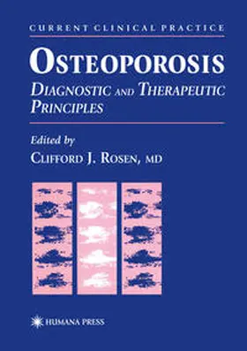 Rosen |  Osteoporosis | eBook | Sack Fachmedien