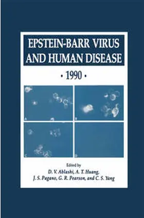 Ablashi / Huang / Pagano | Epstein-Barr Virus and Human Disease · 1990 | E-Book | www.sack.de