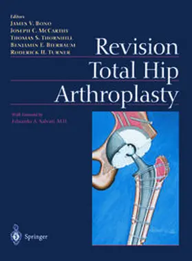Bono / McCarthy / Thornhill |  Revision Total Hip Arthroplasty | eBook | Sack Fachmedien