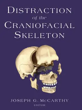 McCarthy | Distraction of the Craniofacial Skeleton | E-Book | www.sack.de