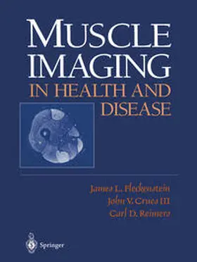 Fleckenstein / Crues / Reimers |  Muscle Imaging in Health and Disease | eBook | Sack Fachmedien