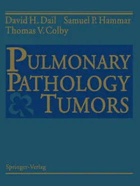 Dail / Hammar / Colby |  Pulmonary Pathology - Tumors | eBook | Sack Fachmedien