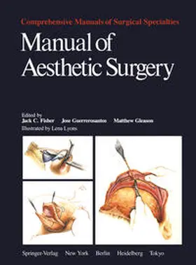 Fisher / Guerrerosantos / Gleason |  Manual of Aesthetic Surgery | eBook | Sack Fachmedien
