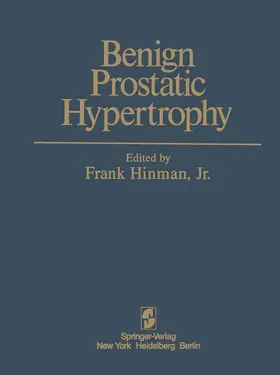  Benign Prostatic Hypertrophy | Buch |  Sack Fachmedien