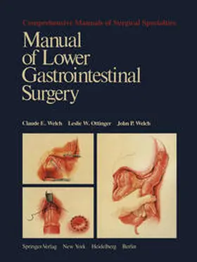 Welch / Ottinger | Manual of Lower Gastrointestinal Surgery | E-Book | sack.de