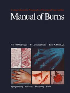 McDougal / Slade / Pruitt |  Manual of Burns | eBook | Sack Fachmedien