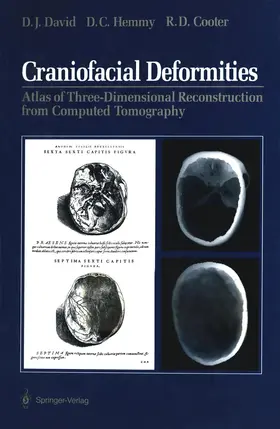 David / Hemmy / Cooter |  Craniofacial Deformities | Buch |  Sack Fachmedien