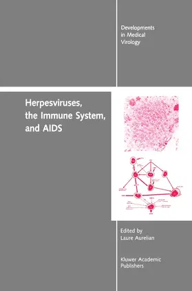Becker / Aurelian |  Herpesviruses, the Immune System, and AIDS | Buch |  Sack Fachmedien