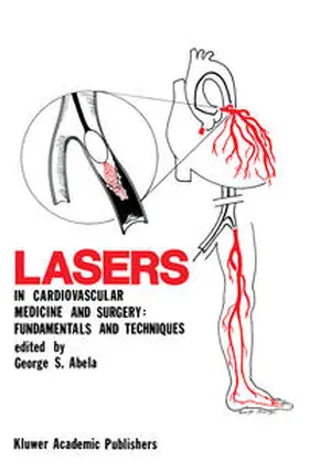 Abela |  Lasers in Cardiovascular Medicine and Surgery: Fundamentals and Techniques | eBook | Sack Fachmedien
