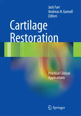 Farr / Gomoll | Cartilage Restoration | E-Book | www.sack.de