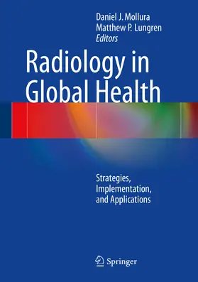 Mollura / Lungren |  Radiology in Global Health | eBook | Sack Fachmedien