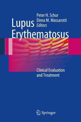 Massarotti / Schur | Lupus Erythematosus | Buch | sack.de