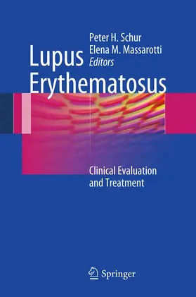 Schur / Massarotti |  Lupus Erythematosus | eBook | Sack Fachmedien