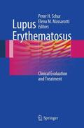 Schur / Massarotti |  Lupus Erythematosus | eBook | Sack Fachmedien