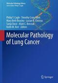 Cagle / Allen / Beasley |  Molecular Pathology of Lung Cancer | Buch |  Sack Fachmedien
