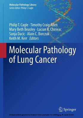 Cagle / Allen / Beasley | Molecular Pathology of Lung Cancer | E-Book | sack.de