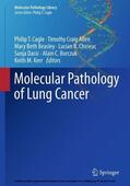 Cagle / Allen / Beasley |  Molecular Pathology of Lung Cancer | eBook | Sack Fachmedien
