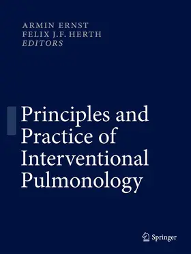 Ernst / Herth | Principles and Practice of Interventional Pulmonology | E-Book | sack.de