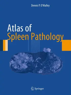 O'Malley |  Atlas of Spleen Pathology | eBook | Sack Fachmedien