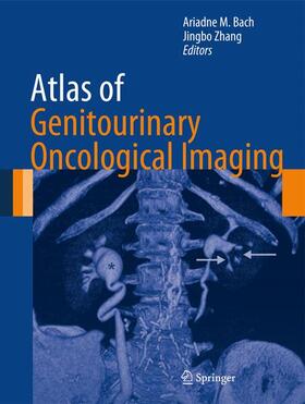 Zhang / Bach | Atlas of Genitourinary Oncological Imaging | Buch | 978-1-4614-4871-6 | sack.de