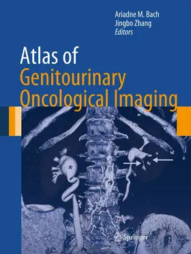 Bach / Zhang |  Atlas of Genitourinary Oncological Imaging | eBook | Sack Fachmedien