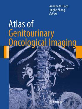 Bach / Zhang | Atlas of Genitourinary Oncological Imaging | E-Book | sack.de