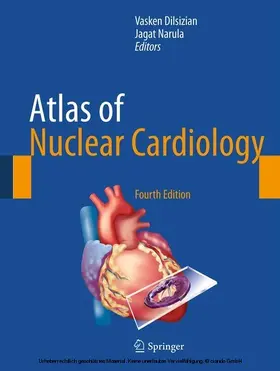 Dilsizian / Narula |  Atlas of Nuclear Cardiology | eBook | Sack Fachmedien
