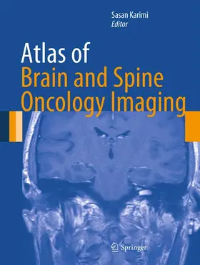 Karimi |  Atlas of Brain and Spine Oncology Imaging | eBook | Sack Fachmedien