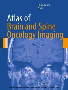 Karimi | Atlas of Brain and Spine Oncology Imaging | E-Book | sack.de