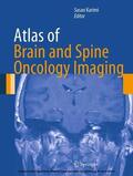 Karimi |  Atlas of Brain and Spine Oncology Imaging | eBook | Sack Fachmedien